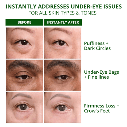 Straffende Creme für die Augenpartie